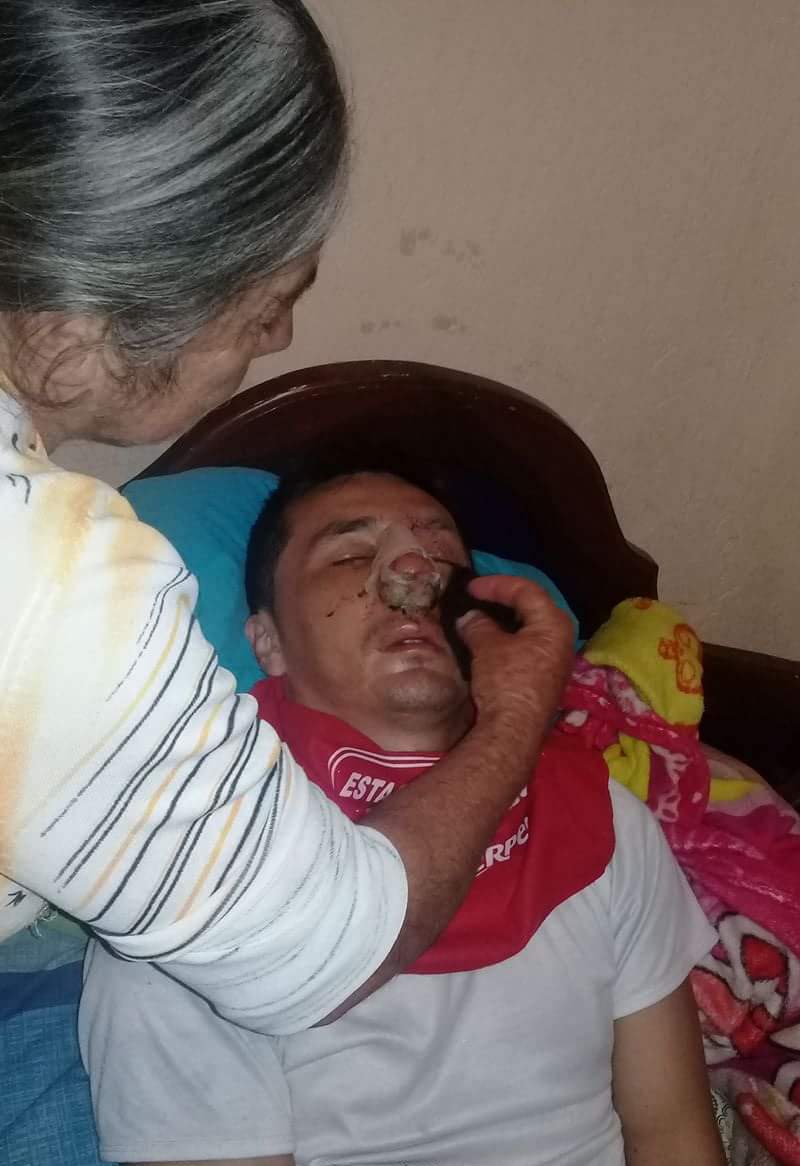 Campaña solidaria para agricultor aceveduno lesionado en aparatoso accidente 5