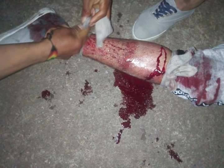 Denuncian caso de asalto armado en vereda de Acevedo 1