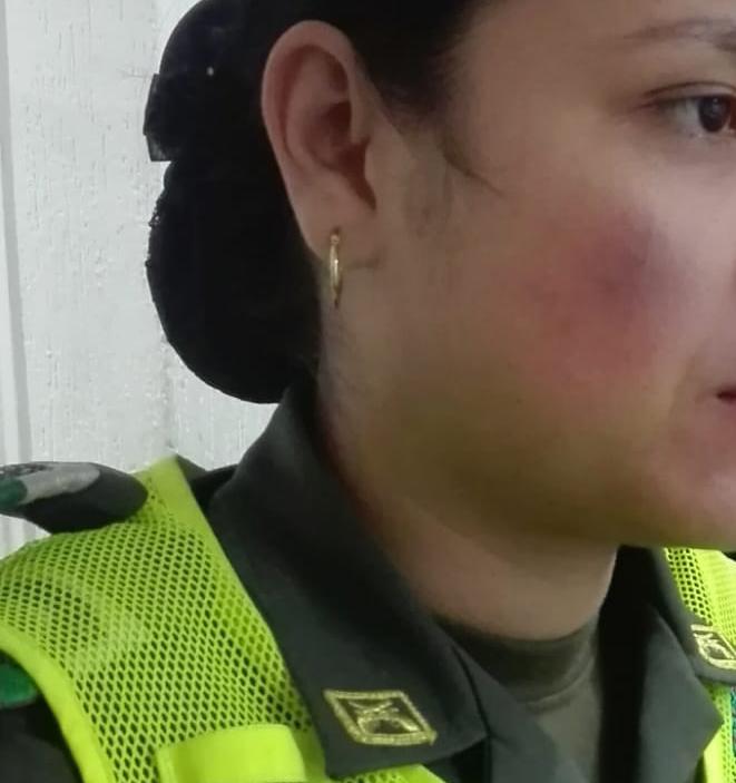 Capturado por golpear a una patrullera de la Policía en Isnos 2