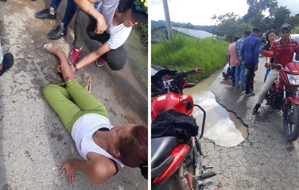 Mujer resultó lesionada tras accidentarse en la vía Acevedo-Pitalito 2