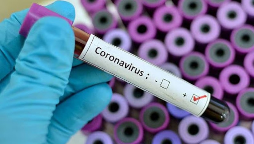 Neiva y Pitalito, imparables en cifra de contagios por coronavirus 1
