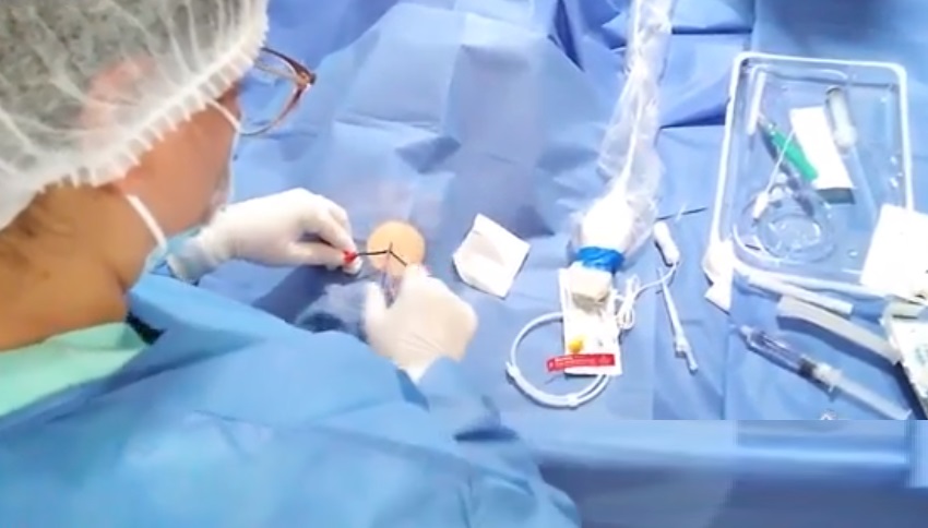 Hospital de Garzón recibió ecógrafo de última tecnología 2