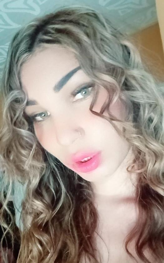 Joven trans neivana falleció por un aparente mal procedimiento estético 1